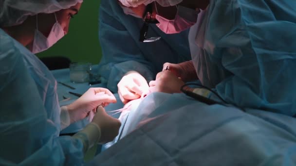 Dokter bedah melakukan operasi pada mata, close-up. Koreksi dari. Dokter melakukan blepharoplasty. Operasi di ruang operasi . — Stok Video