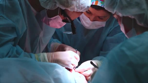 Kirurgen utför en operation på ögonen, närbild. Korrigering av. Läkaren gör ögonlocksplastik. Drift i operationssalen. — Stockvideo