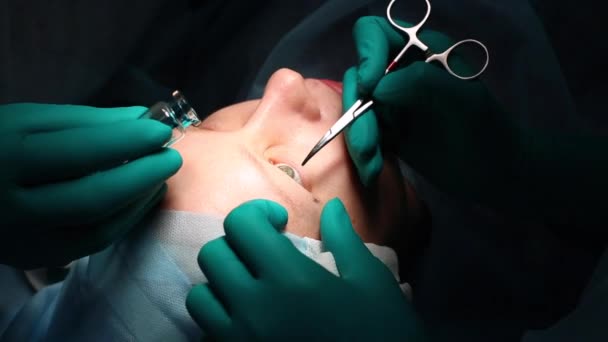 El cirujano está realizando una operación en los ojos, de cerca. El médico hace blefaroplastia. Operación en el quirófano . — Vídeos de Stock