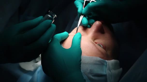 Der Chirurg führt eine Operation an den Augen durch, in Großaufnahme. der Arzt führt Blepharoplastik durch. Operation im Operationssaal. — Stockvideo