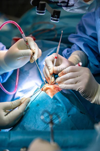Χειρουργός και ο βοηθός του εκτέλεση πλαστικής χειρουργικής επέμβασης στη μύτη σε λειτουργικό δωμάτιο νοσοκομείου. Μύτη αναμόρφωση. Ρινοπλαστική. — Φωτογραφία Αρχείου