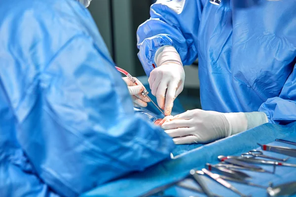 外科医生和他的助手执行整容手术在医院手术室的鼻子上。鼻整形、 隆胸。隆鼻. — 图库照片