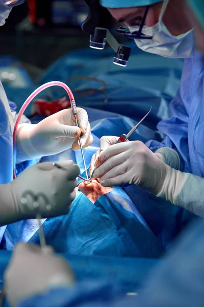 Rhinoplasty close-up of nose surgery. The hands of the surgeon working tools in white gloves, stitched — Stock Photo, Image