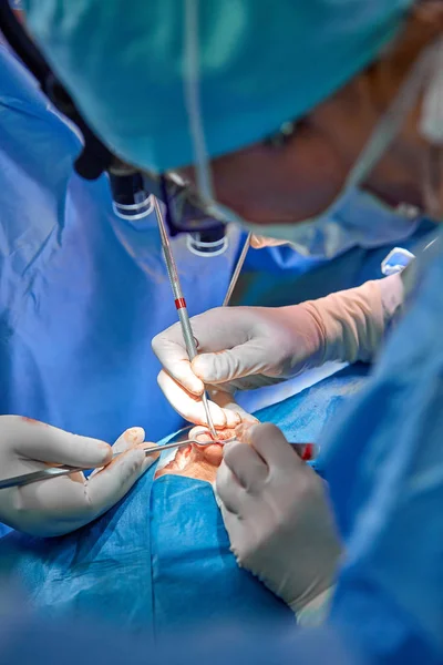 Cirurgião e seu assistente realizando cirurgia estética no nariz na sala de cirurgia do hospital. Reformulação do nariz, aumento. Rinoplastia . — Fotografia de Stock