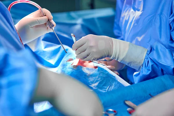 Cirurgião e seu assistente realizando cirurgia estética no nariz na sala de cirurgia do hospital. Reformulação do nariz, aumento. Rinoplastia . — Fotografia de Stock