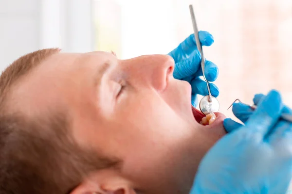 Junger Mann beim Besuch der Zahnarztpraxis. Zahnarzthände in Schutzhandschuhen mit Ultraschall zur Reinigung der Zähne der Patienten. Nahaufnahme des offenen Mundes. — Stockfoto