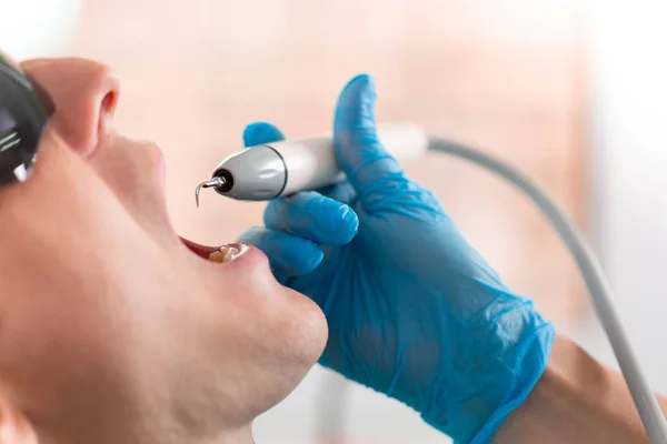 Eine Zahnärztin untersucht die Mundhöhle des Patienten mit einem Werkzeug mit einem Spiegel. Nahaufnahme Porträt eines Patienten mit offenem Mund, ein Arzt in Handschuhen hält einen Zahnspiegel. — Stockfoto