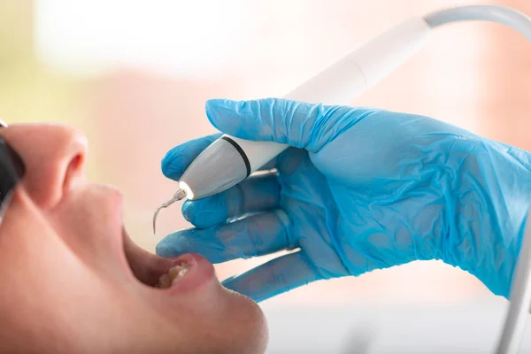 Ręka dentysty w rękawiczce z narzędziem w jego ręce zbliżenie. Nowoczesna stomatologia, zbliżenie, przestrzeń kopiowania. — Zdjęcie stockowe