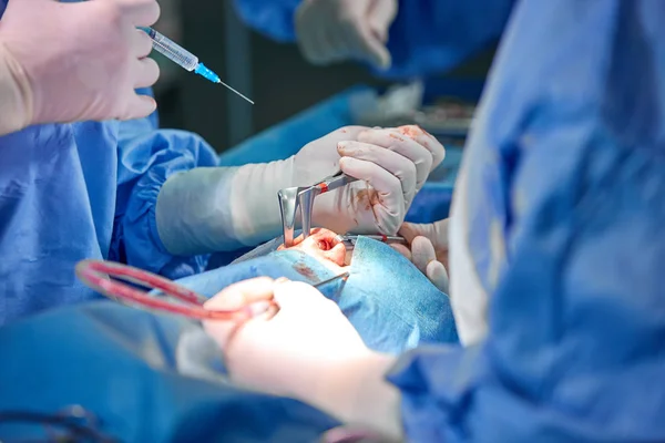 Cirurgião e seu assistente realizando cirurgia estética no nariz na sala de cirurgia do hospital. Reformulação do nariz, aumento. Rinoplastia . — Fotografia de Stock