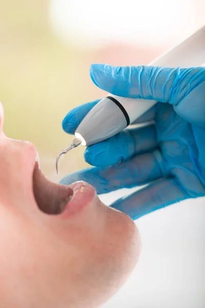 Junger Mann beim Besuch der Zahnarztpraxis. Zahnarzthände in Schutzhandschuhen mit Ultraschall zur Reinigung der Zähne der Patienten. Nahaufnahme des offenen Mundes. — Stockfoto