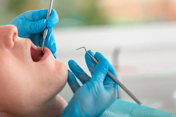 Eine Zahnärztin untersucht die Mundhöhle des Patienten mit einem Werkzeug mit einem Spiegel. Nahaufnahme Porträt eines Patienten mit offenem Mund, ein Arzt in Handschuhen hält einen Zahnspiegel. — Stockfoto