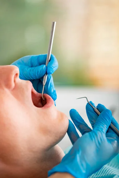 Jonge man een bezoek aan de tandheelkundige kantoor. Tandarts handen in beschermende handschoenen onderzoeken van de tanden van patiënten. Close-up van open mond. — Stockfoto