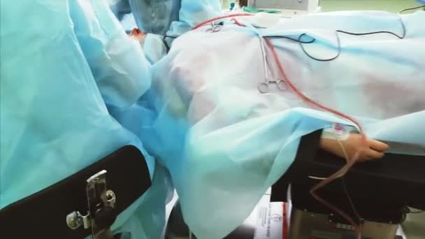 Primer plano de la mano de los médicos, que se dedica a la rinoplastia de la nariz en el hospital — Vídeo de stock