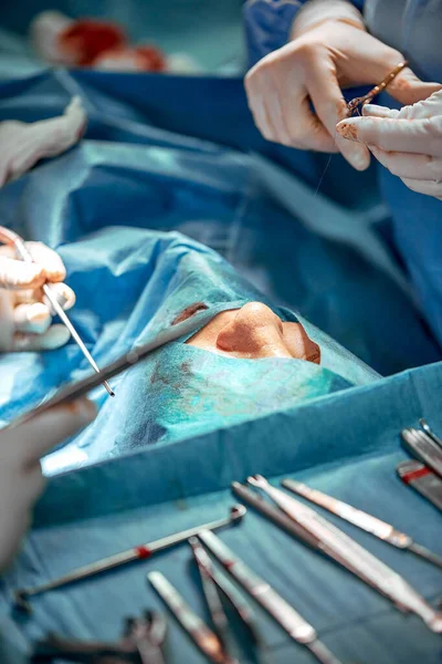 Näsplastik närbild. En riktig operation, ett team av kirurger utför en operation på näsan. Modern medicin, hälsa. — Stockfoto