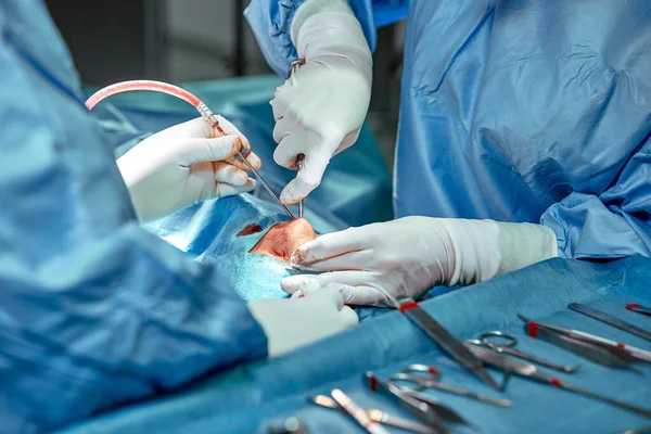 Rinoplastia de cerca. Una operación real, un equipo de cirujanos realiza una operación en la nariz. Medicina moderna, salud . — Foto de Stock