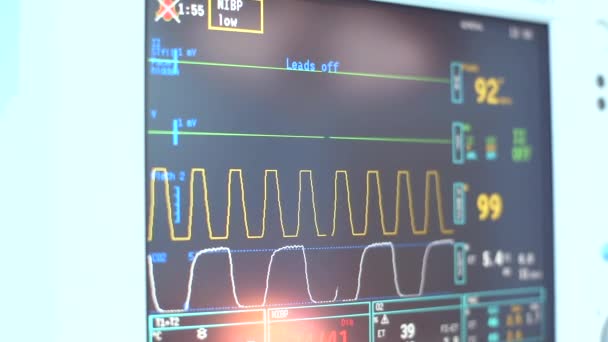 Digitaler Herzmonitor, der aus der Nähe ausgelesen wird, mit Zeilendiagrammen und Nummern des Patienten, der gemessen wird. der digitale Herzmonitor liest eng mit dem Liniendiagramm und dem dargestellten Patienten zusammen — Stockvideo