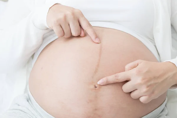 Black Line Belly Pregnant Women Pregnancy Line Linea Nigra Concept — Stock Photo, Image