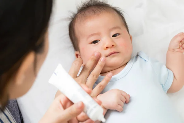 Mother Applying Cream Baby Boy Which Helps Maintain Skin Face — Stock Photo, Image