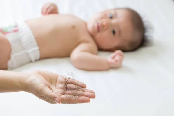 Ibu Ibu Baru Memperhatikan Kehilangan Rambut Sekitar Tiga Bulan Postpartum — Stok Foto