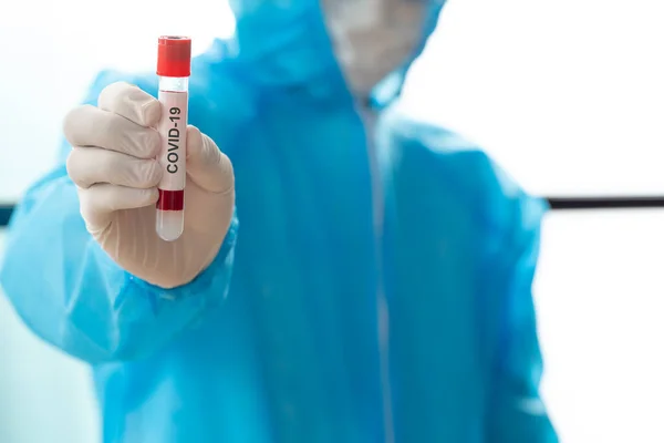 Ppe 착용하고 연구를 사람의 혈액을 보유하고 과학자는 새로운 코로나 바이러스 — 스톡 사진