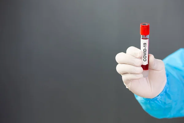 Cientista Médico Vestindo Epi Segurando Sangue Pessoa Infectada Covid Para — Fotografia de Stock