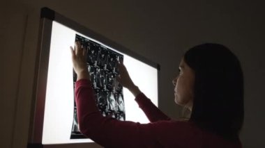 Kadın ameliyattan doktor röntgen sonuçları ışık monitör bakarak