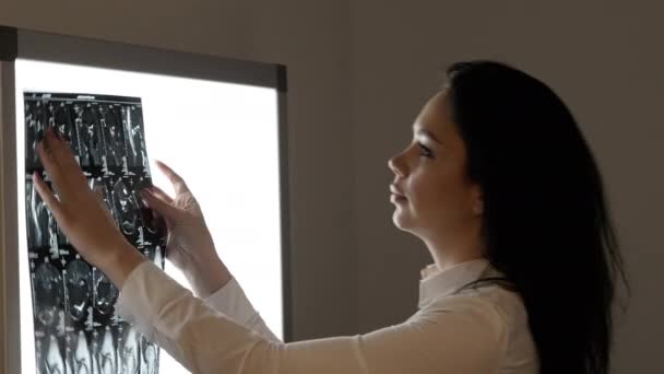 Γυναίκα γιατρό εξετάστε μαγνητική τομογραφία εικόνα στην οθόνη — Αρχείο Βίντεο