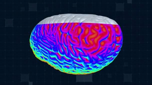 Tdm Cérébrale Antécédents Interface Médicale Fond Médical Full Boucle Sans — Video