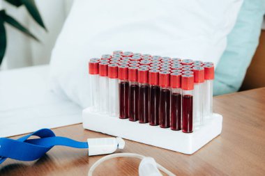 tourniquet and test tubes with blood near bed in clinic clipart
