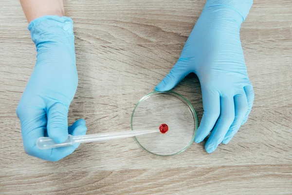 Vista ritagliata del medico in guanti di lattice in possesso di pipetta con campione di sangue — Foto stock