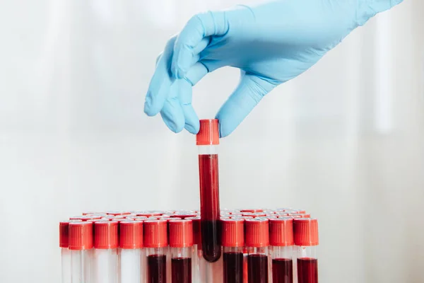 Ausgeschnittene Ansicht eines Arztes im Latex-Handschuh, der Reagenzglas mit Blut hält — Stockfoto