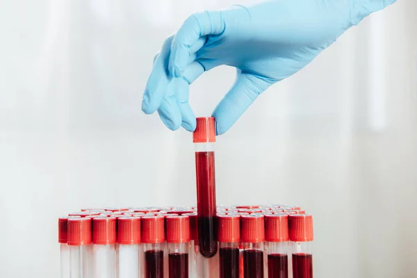 Vista recortada del médico en guante de látex sosteniendo tubo de prueba con sangre - foto de stock