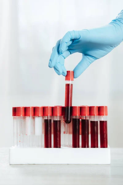 Cropped view of doctor in latex glove holding test tube with blood — Stock Photo