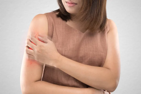 亚洲妇女谁是痒的昆虫叮咬对灰色墙的背景 卫生保健和医药 皮肤问题概念的人 — 图库照片