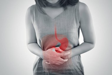Ulcerative Colitis, The photo of large intestine is on the woman's body against gray background, Female anatomy, Concept with healthcare and medicine clipart