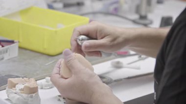 Diş Teknisyeni Porselen İmplantı Diş Çekimi.