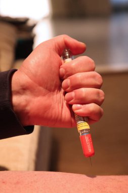 Acil Tıp enjekte ediliyor. Adrenalin otomatik enjektör doz epinefrin veya adrenalin bir iğne bir alerji acı bir hastaya enjekte için tıbbi bir cihazdır