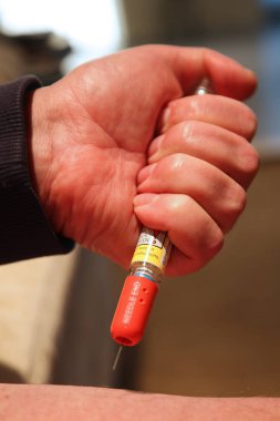 Acil Tıp enjekte ediliyor. Adrenalin otomatik enjektör doz epinefrin veya adrenalin bir iğne bir alerji acı bir hastaya enjekte için tıbbi bir cihazdır