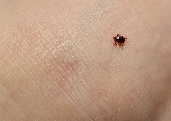 Ixodes Ricinus Ricinus Bab Kullancs Egy Elsősorban Európai Faj Kemény — Stock Fotó