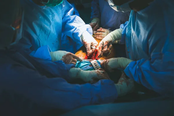 Shot of emergency and serious accident. . The doctor is undergoing surgery to save a life from an accident. Concepts of surgery and emergency accident.