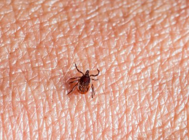 A predatory tick crawls along the human body. Closeup, top view. clipart