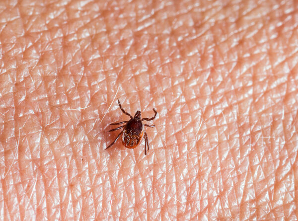 A predatory tick crawls along the human body. Closeup, top view.