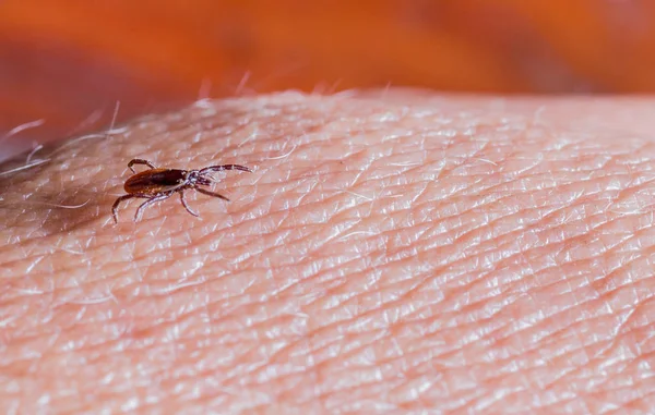 Predatory Parasitic Tick Crawls Human Body Selective Focus Stock Photo