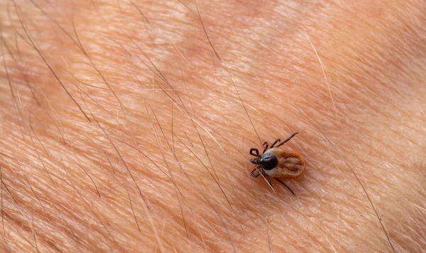 A parasitic tick crawls along on human skin. Close-up, top view.