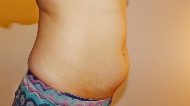 Bir kadın gövde kilolu ile