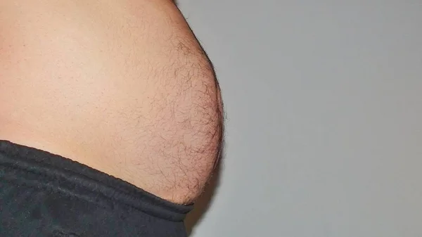 Tipul Arată Mâinile Faldurile Lui Grase Burtă Supraponderali Obezitatea Conceptul — Fotografie, imagine de stoc