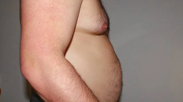 Tipul Arată Mâinile Faldurile Lui Grase Burtă Supraponderali Obezitatea Conceptul — Fotografie, imagine de stoc