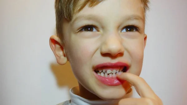 Çocuk Çürük Kötü Diş Ağız Boşluğuna Temizlik — Stok fotoğraf