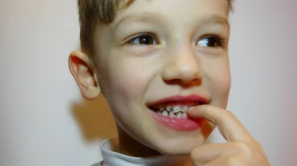 child caries. bad tooth. cleansing of the oral cavity