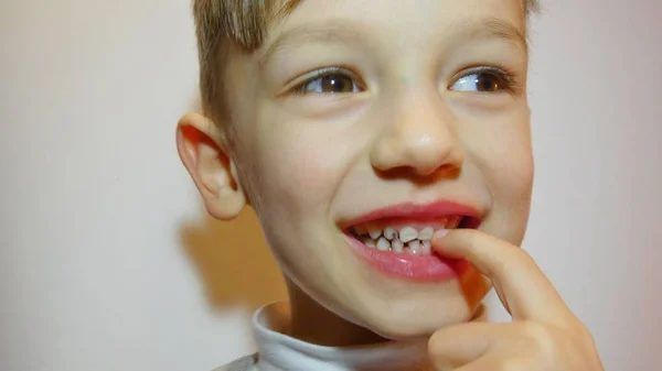 Çocuk Çürük Kötü Diş Ağız Boşluğuna Temizlik — Stok fotoğraf